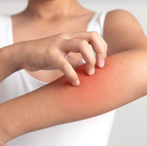 Pomada Caléndula, Piel Sensible e Irritada, Tatto, picadura, heridas